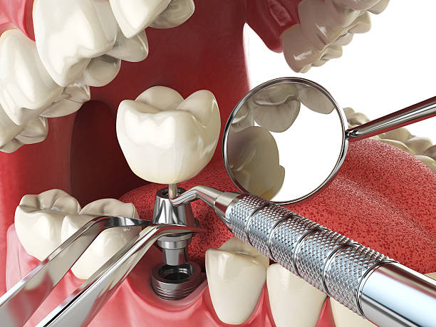 Best Emergency Dental Surgery in Big Lake, TX