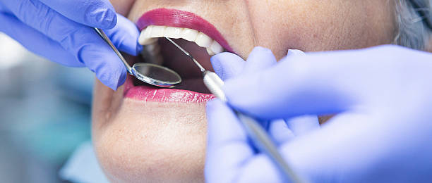 Best Emergency Root Canal Treatment in Big Lake, TX